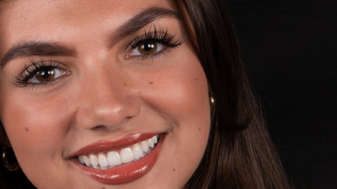 Dream Smile Dental London